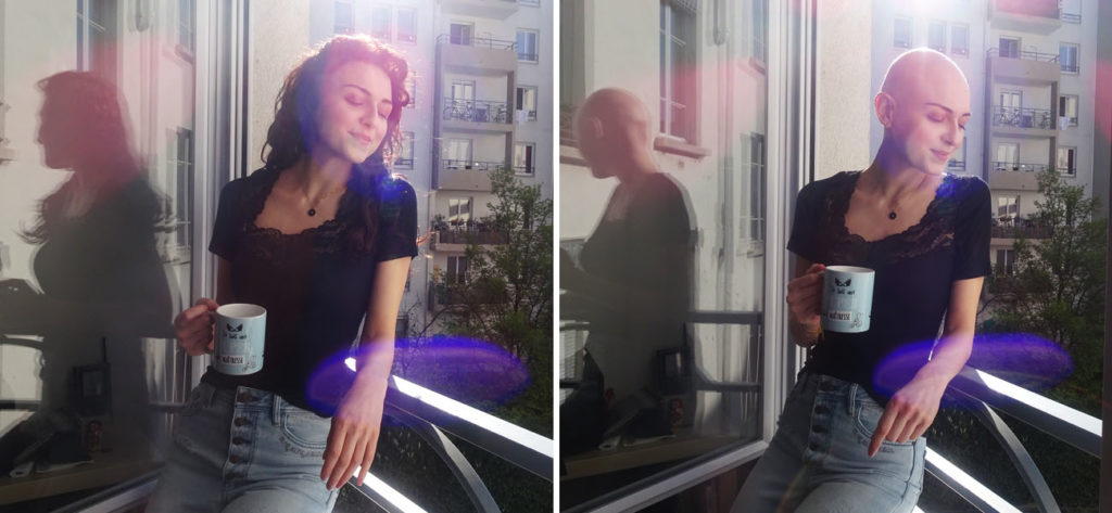PlayGround entrevista testimonio mujer alopecia