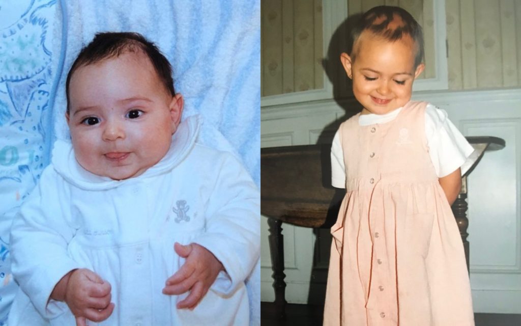 Elodie_bebé_alopecia_mujeres